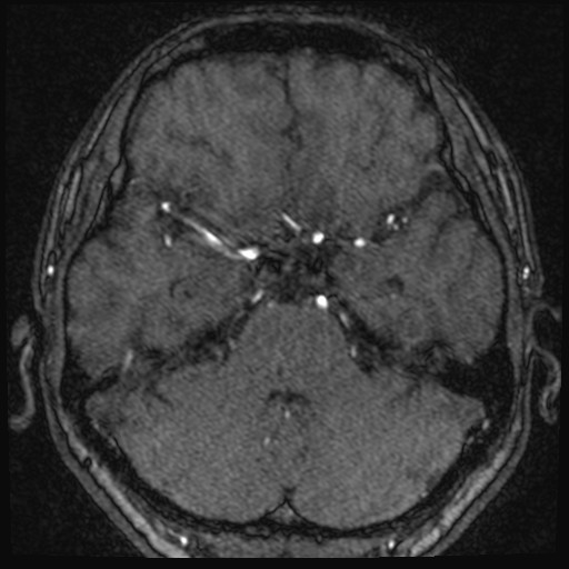 Click on the Serie image to view the images of VILLANUEVA, WILLIAM A.